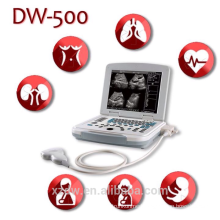 2016 hot sale and durable usb probe ultrasound scanner